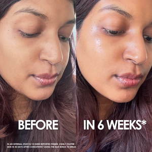 Age Minus 10 Serum – a botox like peptide that is known to reverse ageing in 45 days