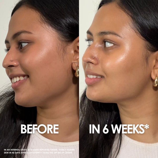 Lift Me Up Cream – clinically proven to outperform retinol - without the redness
